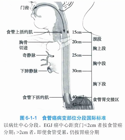 2025版食管分段诊断新标准深度解析